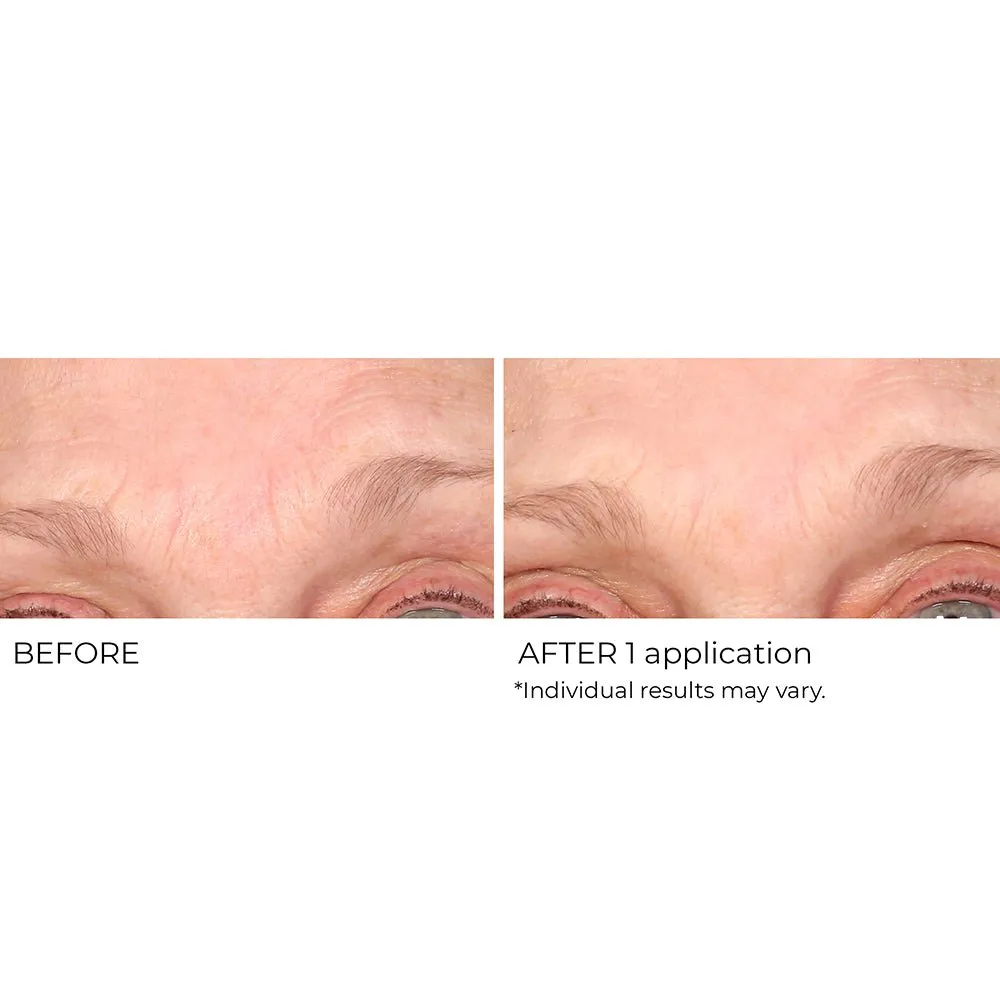 Wrinkle Blur Targeted Treatment