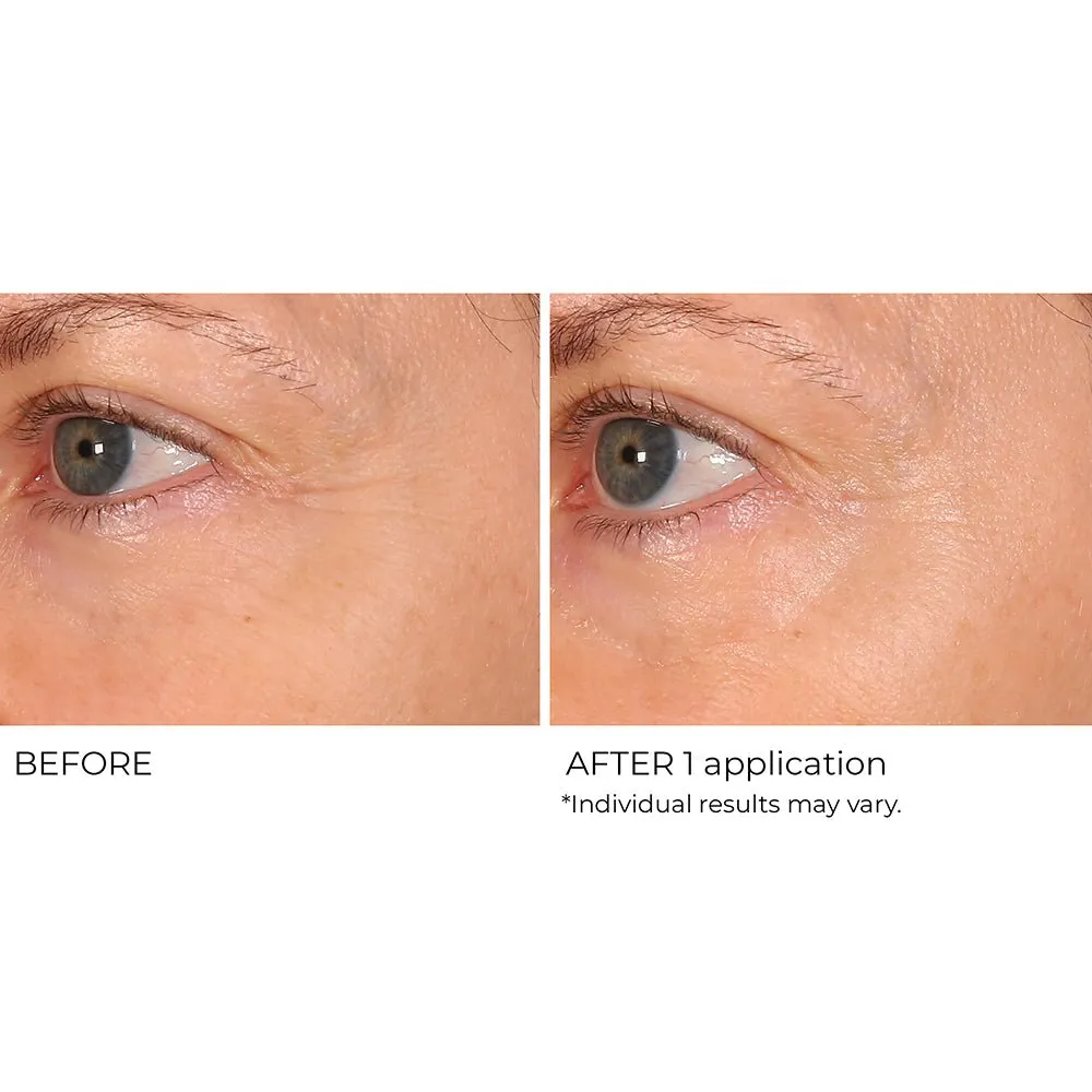 Wrinkle Blur Targeted Treatment